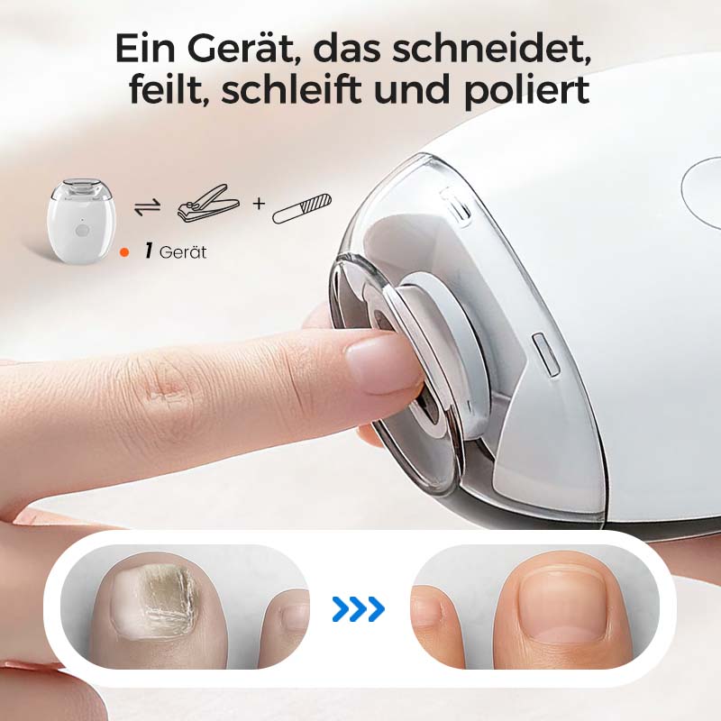 🎁50% Rabatt 🥳💞 50K+ VERKAUFT! ⚡Universelle automatische Nagelfeile für Erwachsene und Kinder👶