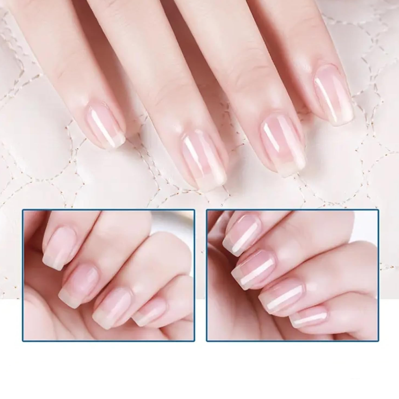 📢📢50% Rabatt!! + MEHRKAUF-BONUS 🏆 💅 Hochglänzendes Nagelöl – Brüchige Nägel Vergessen! Glänzend, Stark &amp; Pflegt in Sekunden! ✨